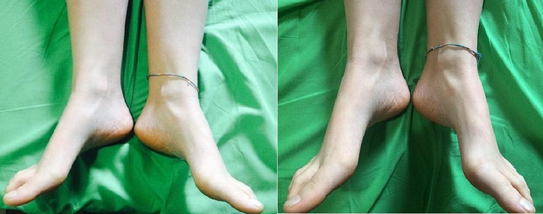 Riallineamento Vertebrale 16 Riallineamento Vertebrale Riallineamento Vertebrale