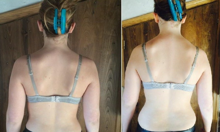 Riallineamento Vertebrale 15 Riallineamento Vertebrale Riallineamento Vertebrale